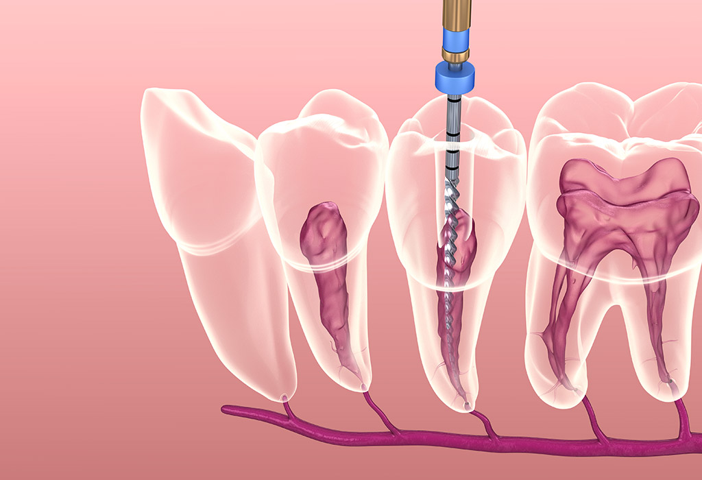 odontología conservadora en El Masnou (Maresme)