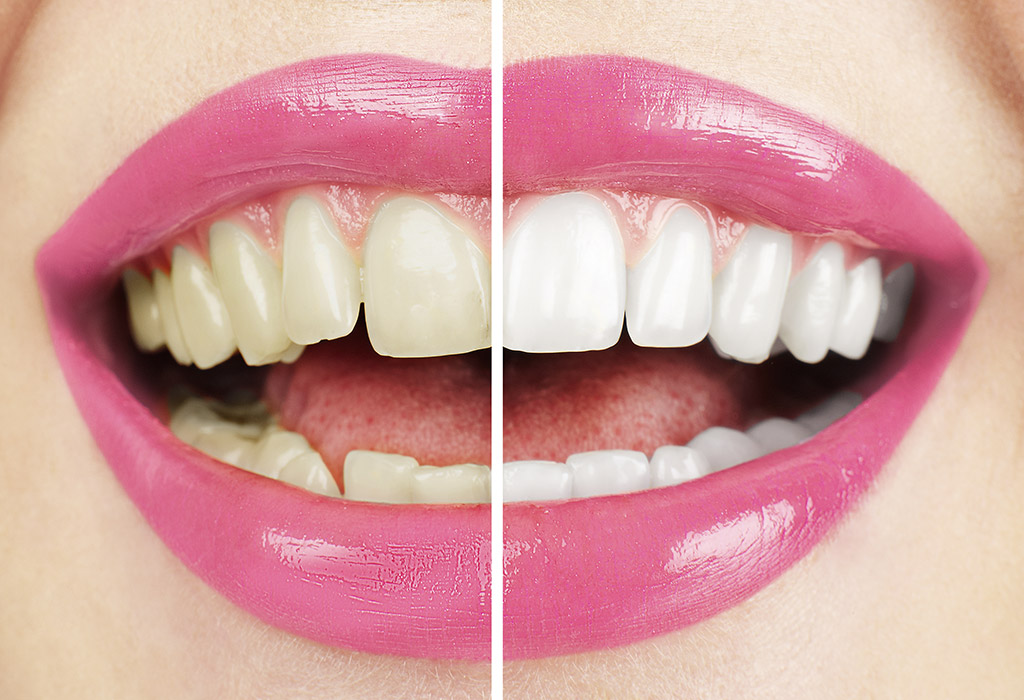 estética dental en El Masnou (Maresme)