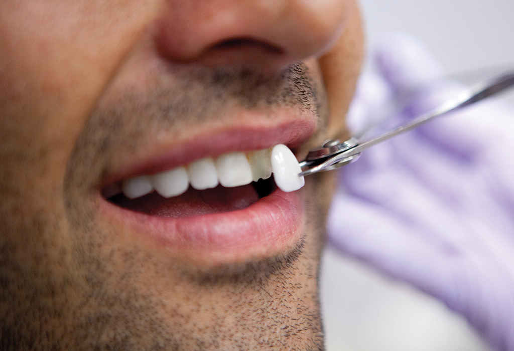 estética dental en El Masnou (Maresme)