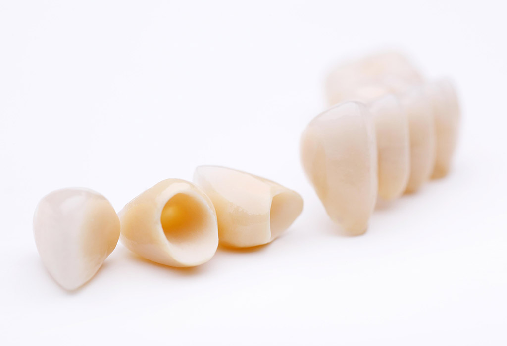 estética dental en El Masnou (Maresme)